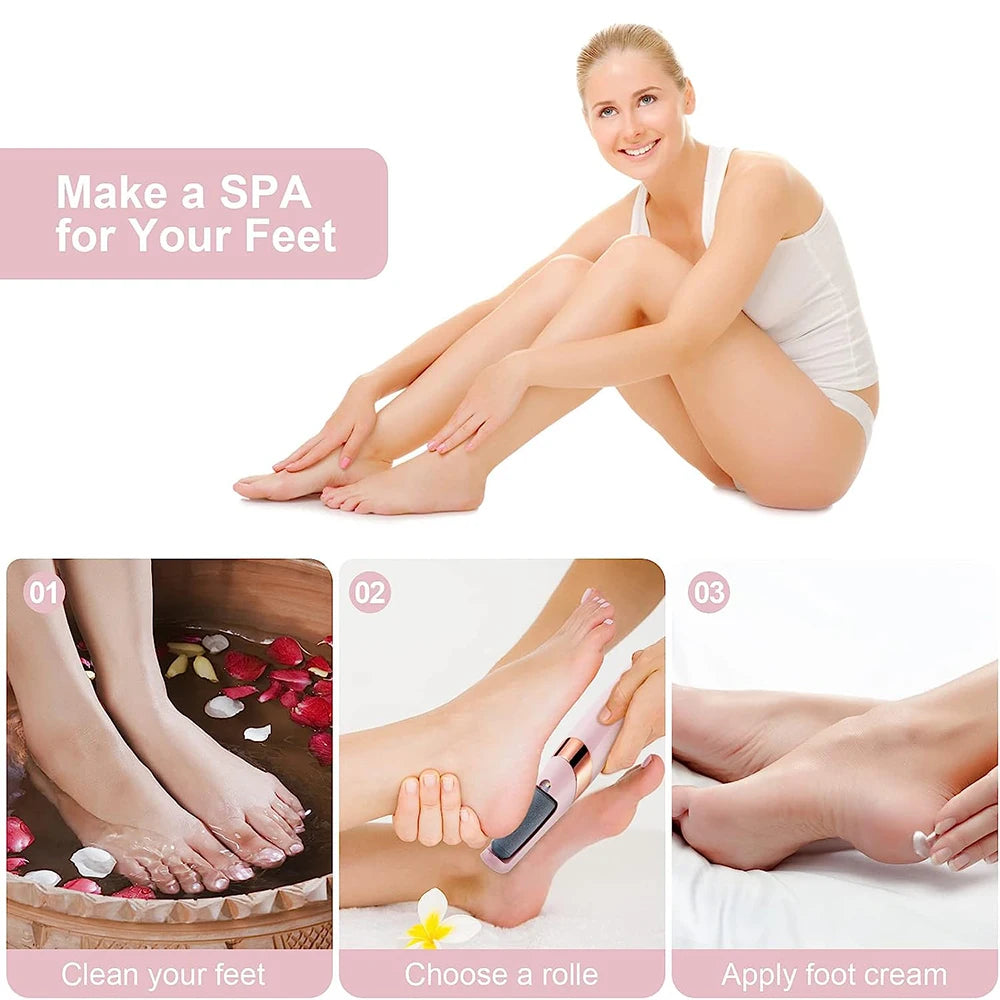SmoothFeet Pro Callus Remover