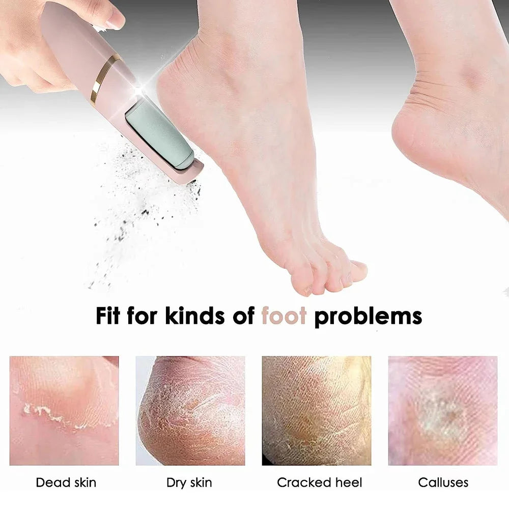 SmoothFeet Pro Callus Remover